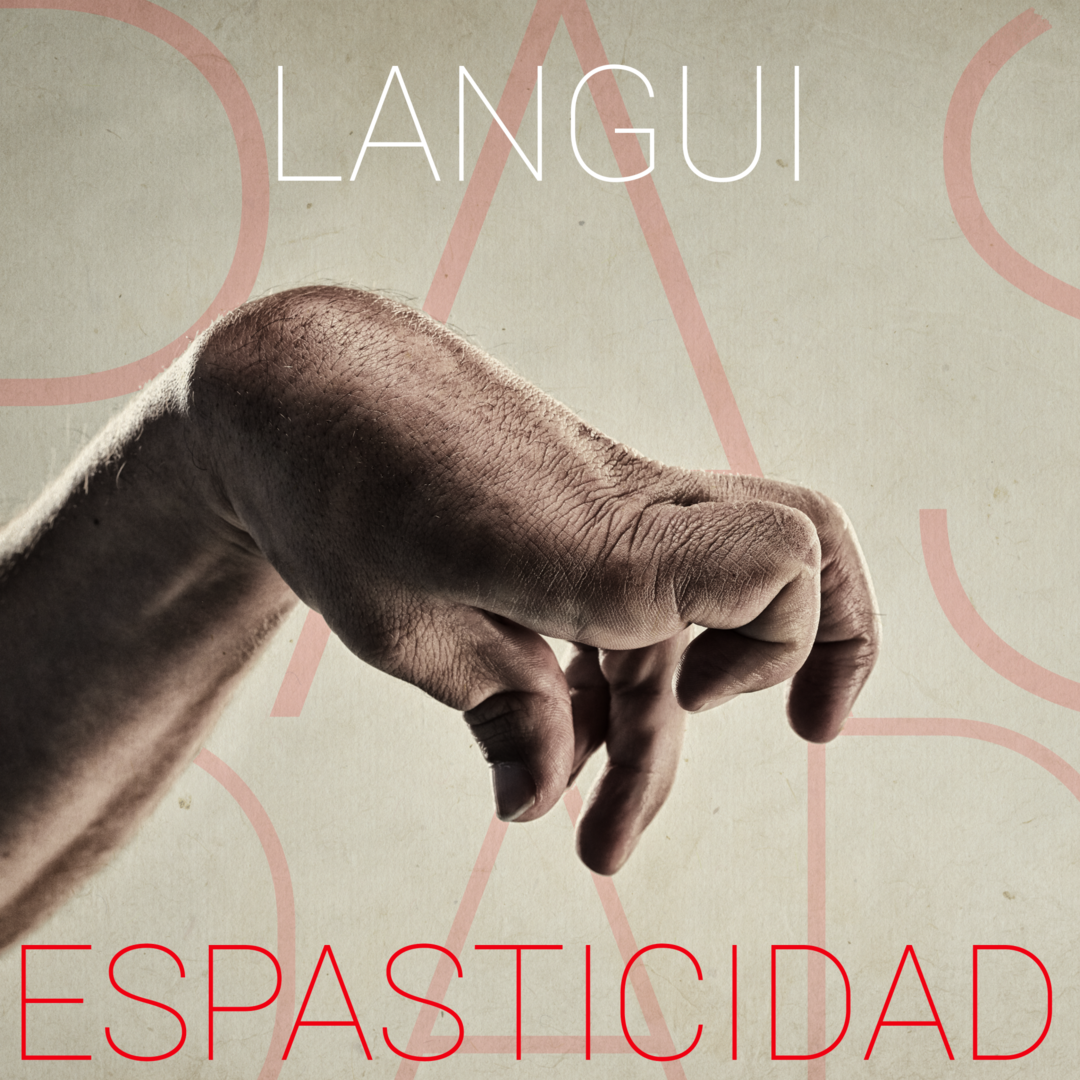 Espasticidad CD